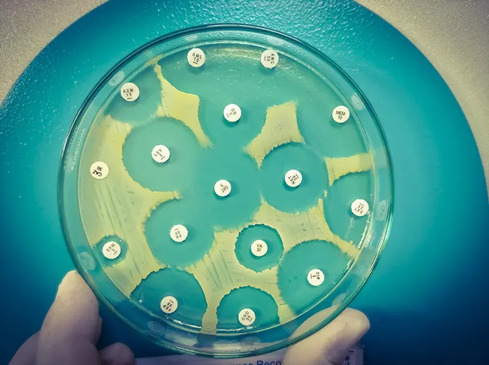 فلزات ضد میکروبی چگونه کار می کنند